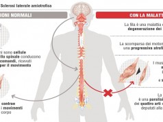 Sla