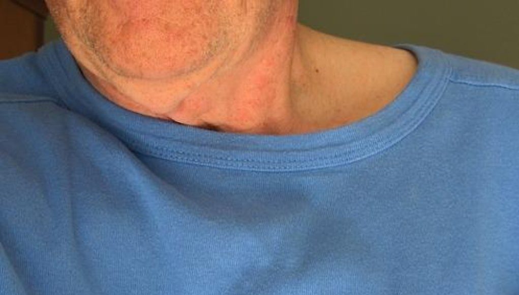 Chi sono i “Pacemaker” nelle maratone e perché sono fondamentali