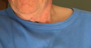 Chi sono i “Pacemaker” nelle maratone e perché sono fondamentali