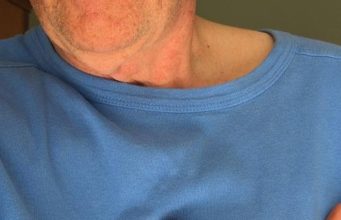 Chi sono i “Pacemaker” nelle maratone e perché sono fondamentali
